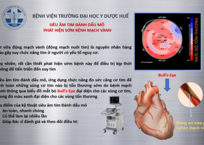 Poster truyền thông, giáo dục sức khỏe - Bệnh mạch vành